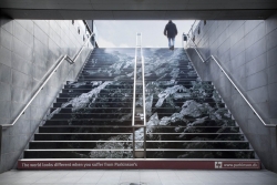 Parkinson's Disease: Stairs