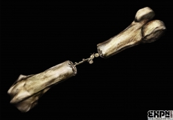 EXPN: Bones