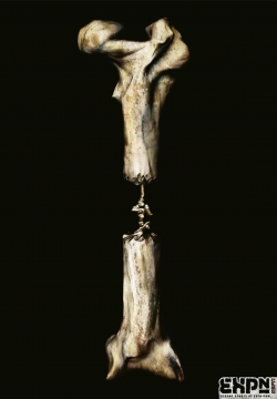 EXPN: Bones
