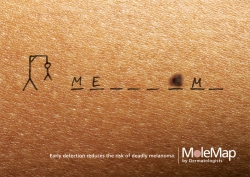 MoleMap by Dermatologists: Hangman