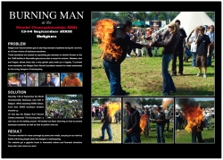 Belgian Burn Wound Center: Burning man