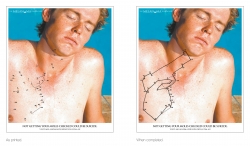 Melanoma Foundation: Gun