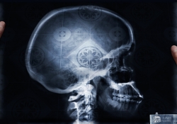 Mr Clean: X-ray