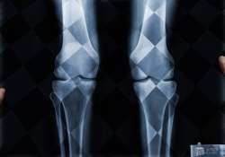 Mr Clean: X-ray