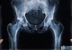 Mr Clean: X-ray