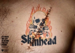 France Adot: Tattoos - Skin