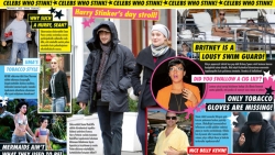 BURN! We burn celebrities!: BURN!: CELEB WHO STINKS!