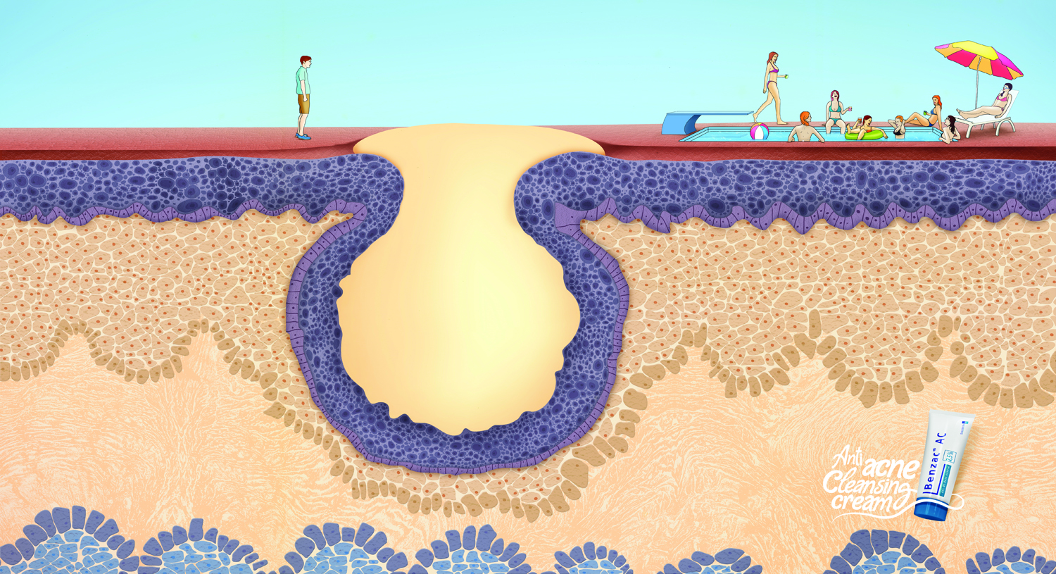 tenovate gn for ringworm tenovate how it works
